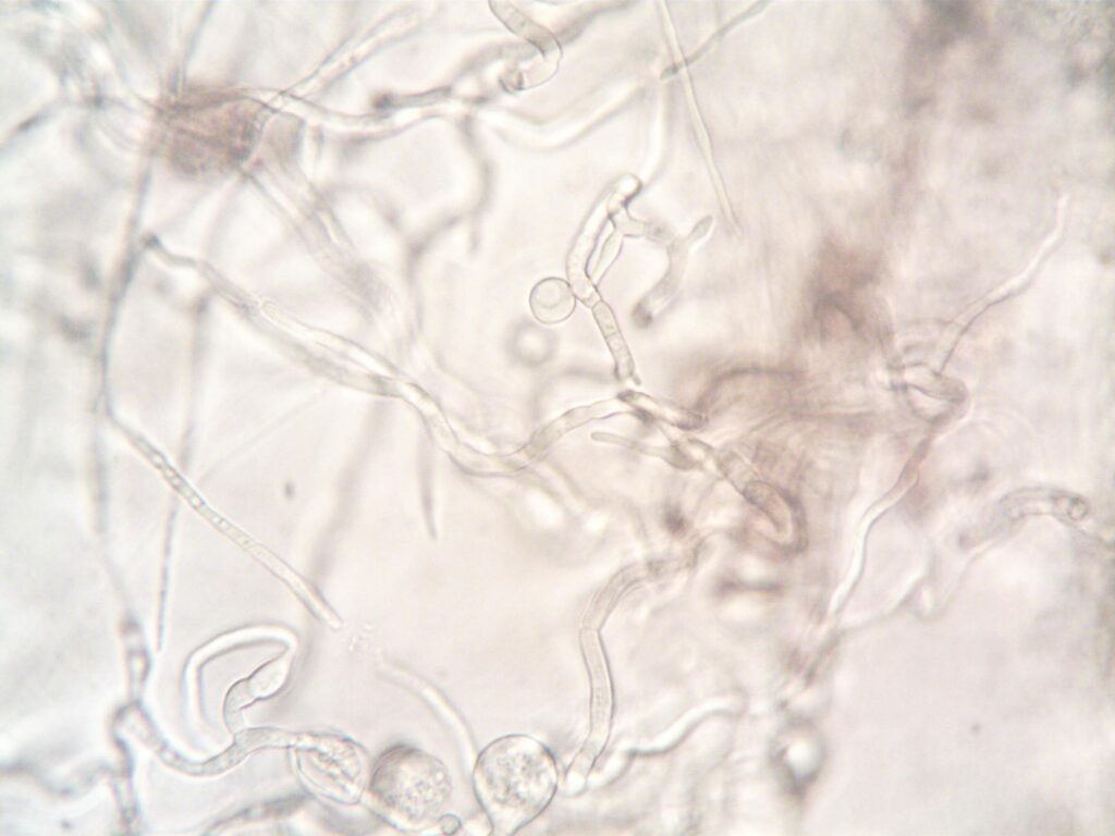 Close-up of fungal mycelium in soil near tree roots illustrating soil-borne pathogens